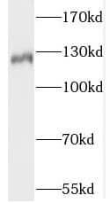 Western Blot: SLC4A8 Antibody - BSA Free [NBP3-45904] - Human brain tissue were subjected to SDS PAGE followed by western blot with (SLC4A8 antibody) at dilution of 1:300