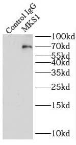 Immunoprecipitation: MKS1 Antibody - BSA Free [NBP3-45910] - IP Result of anti-MKS1 (IP:, 3ug; Detection: 1:1000) with HEK-293 cells lysate 4500ug.