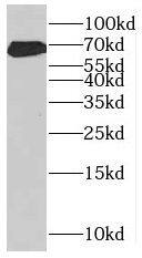 Western Blot MKS1 Antibody - BSA Free