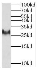 Western Blot: MITD1 Antibody - BSA Free [NBP3-45911] - HeLa cells were subjected to SDS PAGE followed by western blot with (MITD1 antibody) at dilution of 1:500