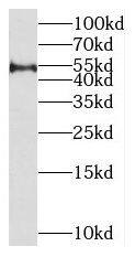 Western Blot: MIPOL1 Antibody - BSA Free [NBP3-45912] - HepG2 cells were subjected to SDS PAGE followed by western blot with (MIPOL1 antibody) at dilution of 1:800