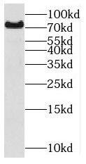 Western Blot: MIPEP Antibody - BSA Free [NBP3-45913] - HepG2 cells were subjected to SDS PAGE followed by western blot with (MIPEP antibody) at dilution of 1:1000