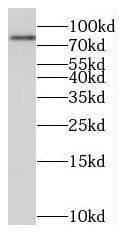 Western Blot: MIER1 Antibody - BSA Free [NBP3-45915] - Human testis tissue were subjected to SDS PAGE followed by western blot with (MIER1 antibody) at dilution of 1:500
