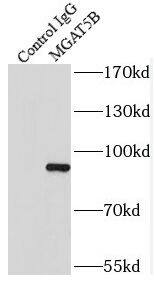 Immunoprecipitation MGAT5B Antibody - BSA Free
