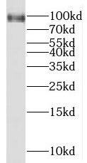 Western Blot MGAT5B Antibody - BSA Free