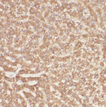Immunohistochemistry MGAT2 Antibody - BSA Free