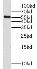 Western Blot MGAT2 Antibody - BSA Free