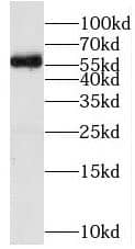 Western Blot MFSD8 Antibody - BSA Free