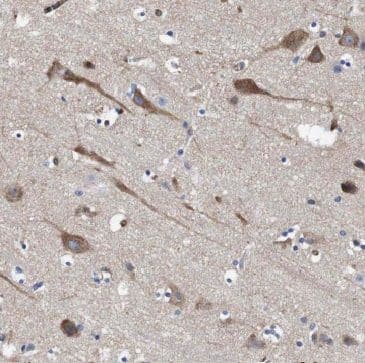 Immunohistochemistry MFSD8 Antibody - BSA Free
