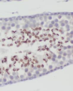 Immunohistochemistry MFSD2 Antibody - BSA Free