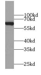 Western Blot MFSD2 Antibody - BSA Free