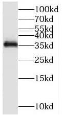 Western Blot: MFAP4 Antibody - BSA Free [NBP3-45928] - Human kidney tissue were subjected to SDS PAGE followed by western blot with (MFAP4 antibody) at dilution of 1:600