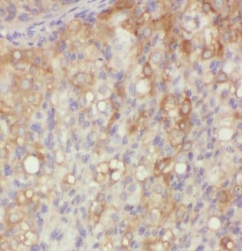 Immunohistochemistry: MFAP4 Antibody - BSA Free [NBP3-45928] - Immunohistochemistry of paraffin-embedded human ovary using (MFAP4 antibody) at dilution of 1:100