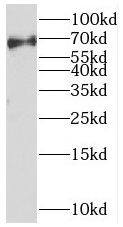 Western Blot: MEX3C Antibody - BSA Free [NBP3-45929] - HeLa cells were subjected to SDS PAGE followed by western blot with (MEX3C antibody) at dilution of 1:1000