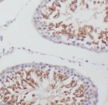 Immunohistochemistry: MEX3C Antibody - BSA Free [NBP3-45929] - Immunohistochemistry of paraffin-embedded human testis tissue slide using (MEX3C Antibody) at dilution of 1:50