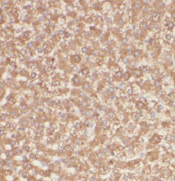 Immunohistochemistry METTL7B Antibody - BSA Free