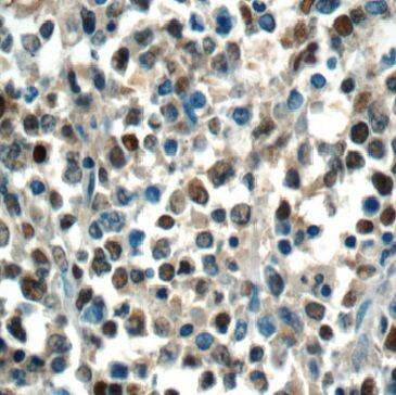 Immunohistochemistry MEF2BNB Antibody - BSA Free