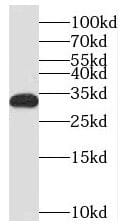 Western Blot: MEF2BNB Antibody - BSA Free [NBP3-45935] - Human brain tissue were subjected to SDS PAGE followed by western blot with (MEF2BNB antibody) at dilution of 1:1000