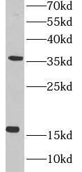 Western Blot: MED10 Antibody - BSA Free [NBP3-45942] - COLO320 cells were subjected to SDS PAGE followed by western blot with ( MED10 Antibody) at dilution of 1:500