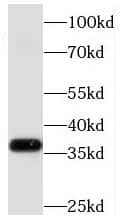 Western Blot: MECR Antibody - BSA Free [NBP3-45943] - Mouse heart tissue were subjected to SDS PAGE followed by western blot with (MECR antibody) at dilution of 1:500