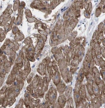 Immunohistochemistry: MECR Antibody - BSA Free [NBP3-45943] - Immunohistochemistry of paraffin-embedded human heart using (MECR antibody) at dilution of 1:100
