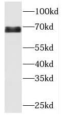 Western Blot: MBTD1 Antibody - BSA Free [NBP3-45947] - Jurkat cells were subjected to SDS PAGE followed by western blot with ( MBTD1 Antibody) at dilution of 1:600