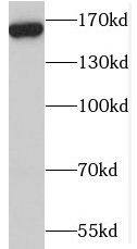 Western Blot: MBD5 Antibody - BSA Free [NBP3-45949] - Mouse heart tissue were subjected to SDS PAGE followed by western blot with (MBD5 antibody) at dilution of 1:500