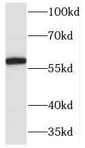 Western Blot: MARCKS like protein Antibody - BSA Free [NBP3-45955] - Mouse brain tissue were subjected to SDS PAGE followed by western blot with (MARCKS like protein antibody) at dilution of 1:500