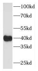 Western Blot MAP9 Antibody - BSA Free