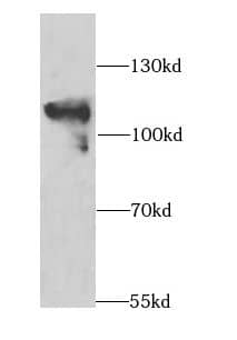 Western Blot: MAP4K3 Antibody - BSA Free [NBP3-45957] - Human skeletal muscle tissue were subjected to SDS PAGE followed by western blot with (MAP4K3 antibody) at dilution of 1:1000