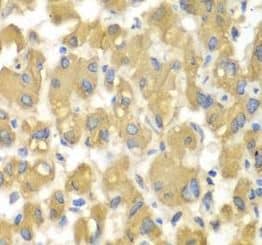 Immunohistochemistry MAP4K3 Antibody - BSA Free
