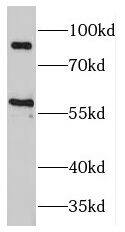 Western Blot: MAP4K2 Antibody - BSA Free [NBP3-45958] - Mouse brain tissue were subjected to SDS PAGE followed by western blot with (MAP4K2 antibody) at dilution of 1:300