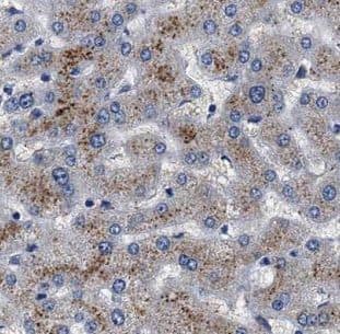 Immunohistochemistry MAGT1 Antibody - BSA Free