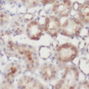 Immunohistochemistry: MAGIX Antibody - BSA Free [NBP3-45967] - Immunohistochemistry of paraffin-embedded human kidney tissue slide using ( MAGIX Antibody) at dilution of 1:50