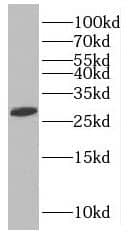 Western Blot MAGEH1 Antibody - BSA Free
