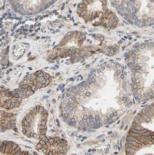 Immunohistochemistry MAGEH1 Antibody - BSA Free