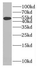 Western Blot: MAGED4B Antibody - BSA Free [NBP3-45970] - Jurkat cells were subjected to SDS PAGE followed by western blot with (MAGED4B antibody) at dilution of 1:5000