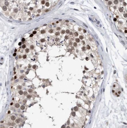 Immunohistochemistry: Melanoma antigen family C2 Antibody - BSA Free [NBP3-45972] - Immunohistochemistry of paraffin-embedded human testis tissue slide using ( Melanoma antigen family C2 Antibody) at dilution of 1:50