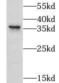 Western Blot: LYSMD3 Antibody - BSA Free [NBP3-45981] - Neuro-2a cells were subjected to SDS PAGE followed by western blot with (LYSMD3 antibody) at dilution of 1:500