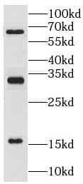 Western Blot: Ly-6G5C Antibody - BSA Free [NBP3-45984] - Mouse spleen tissue were subjected to SDS PAGE followed by western blot with (Ly-6G5C antibody) at dilution of 1:1000