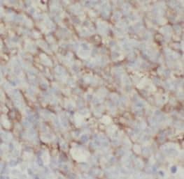 Immunohistochemistry: Ly6D Antibody - BSA Free [NBP3-45987] - Immunohistochemistry of paraffin-embedded human tonsillitis tissue slide using (Ly6D Antibody) at dilution of 1:50