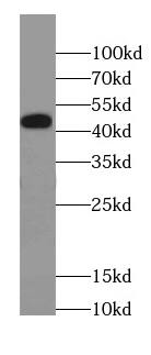Western Blot: Cav1.2 Antibody - BSA Free [NBP3-45988] - Transfected HEK-293 cells were subjected to SDS PAGE followed by western blot with (Cav1.2 Antibody) at dilution of 1:2000