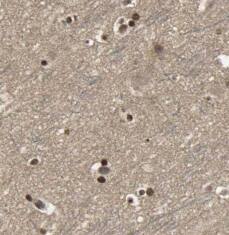 Immunohistochemistry: Cav1.2 Antibody - BSA Free [NBP3-45988] - Immunohistochemistry of paraffin-embedded rat brain tissue slide using (Cav1.2 Antibody) at dilution of 1:200