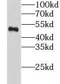 Western Blot: LSM11 Antibody - BSA Free [NBP3-45996] - HeLa cells were subjected to SDS PAGE followed by western blot with (LSM11 antibody) at dilution of 1:600