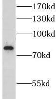 Western Blot: LRSAM1 Antibody - BSA Free [NBP3-45999] - Jurkat cells were subjected to SDS PAGE followed by western blot with (LRSAM1 Antibody) at dilution of 1:1000