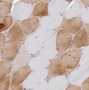 Immunohistochemistry: LRSAM1 Antibody - BSA Free [NBP3-45999] - Immunohistochemistry of paraffin-embedded human skeletal muscle slide using (LRSAM1 Antibody) at dilution of 1:50
