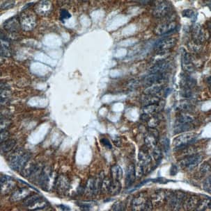 Immunohistochemistry: LRCH2 Antibody - BSA Free [NBP3-46008] - Immunohistochemistry of paraffin-embedded human colon tissue slide using (LRCH2 Antibody) at dilution of 1:50