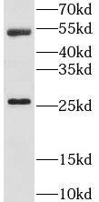 Western Blot: LRAT Antibody - BSA Free [NBP3-46010] - Mouse testis tissue were subjected to SDS PAGE followed by western blot with (LRAT Antibody) at dilution of 1:2000
