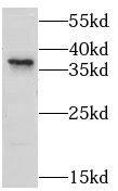 Western Blot LPPR2 Antibody - BSA Free