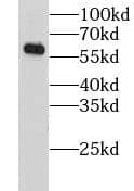 Western Blot: AGPAT7 Antibody - BSA Free [NBP3-46012] - Mouse brain tissue were subjected to SDS PAGE followed by western blot with (AGPAT7 antibody) at dilution of 1:300